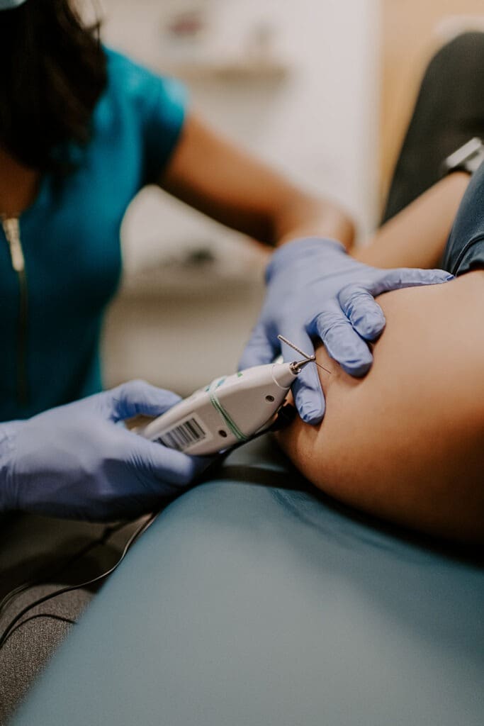 dry needling at roots physical therapy