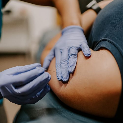 roots physical therapy dry needling Rhode Island
